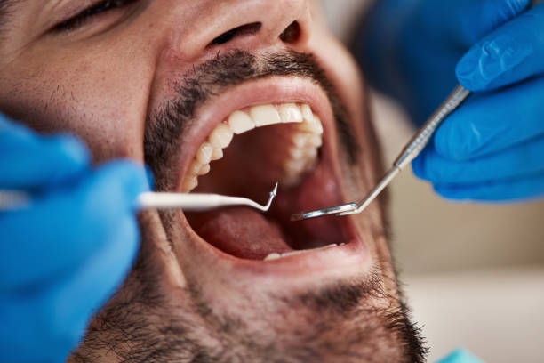 Best Emergency Treatment for Oral Infections in Rathdrum, ID