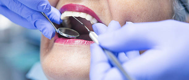 Best Dental Abscess Treatment in Rathdrum, ID